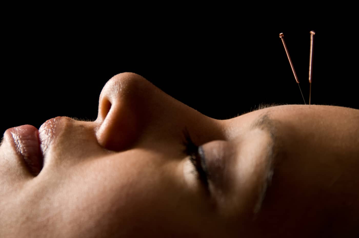 acupuntura medicina chinesa ceimec