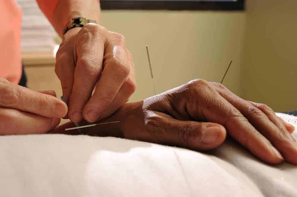 acupuntura mao marcus yu bin pai