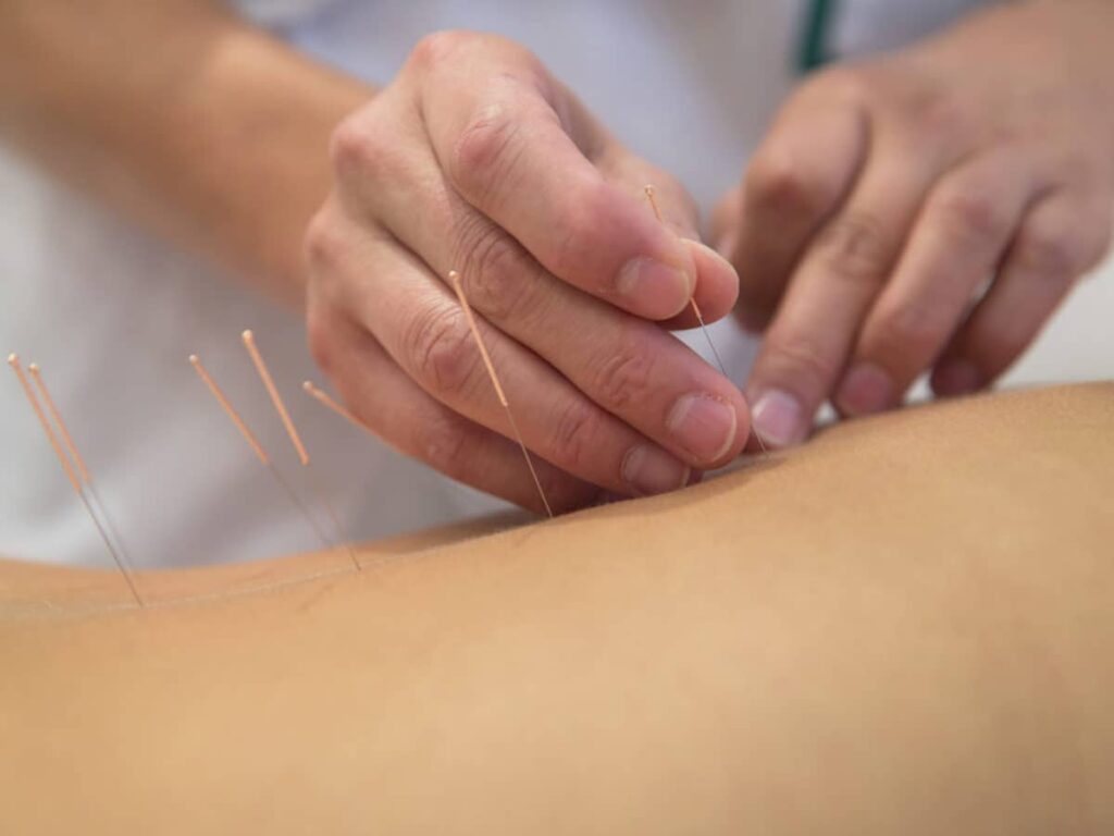 Arquivo: Especialização em Acupuntura Médica 2018