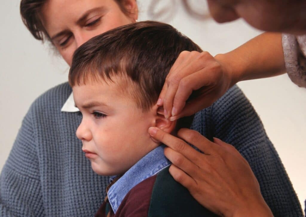 acupuntura em criancas