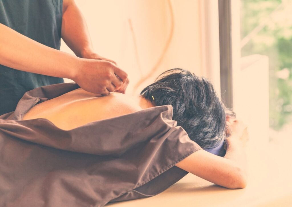 tratamento acupuntura