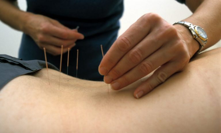 Acupuntura30