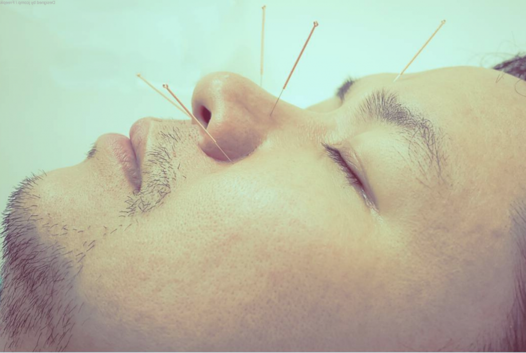 acupuntura medica sao paulo10