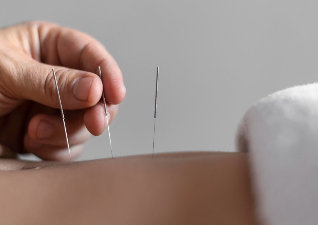 acupuntura medica sao paulo12