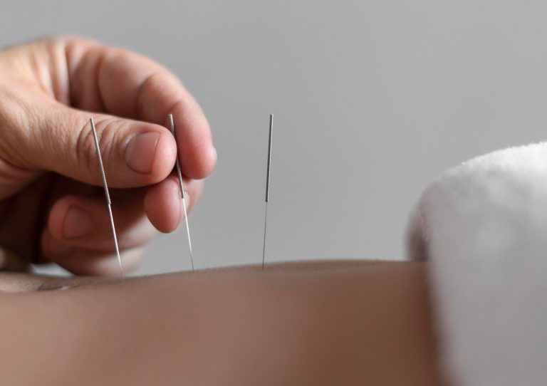 acupuntura medica sao paulo12