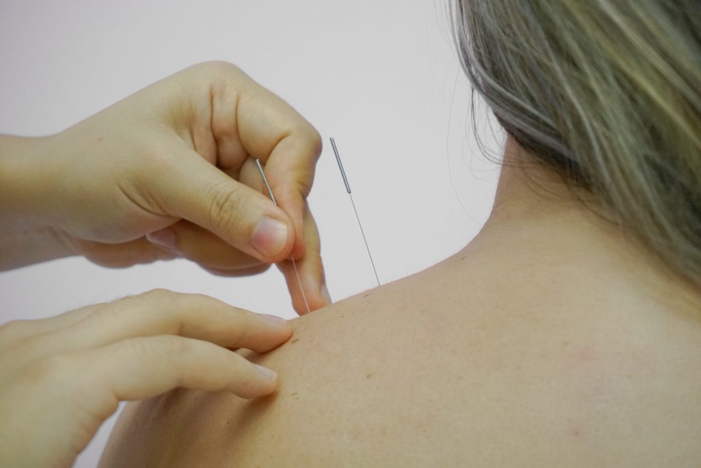 Neuralgia occipital: dor em choque na nuca e no couro cabeludo