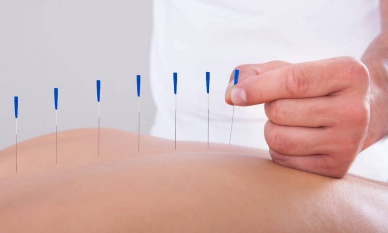 acupuntura medica sao paulo34