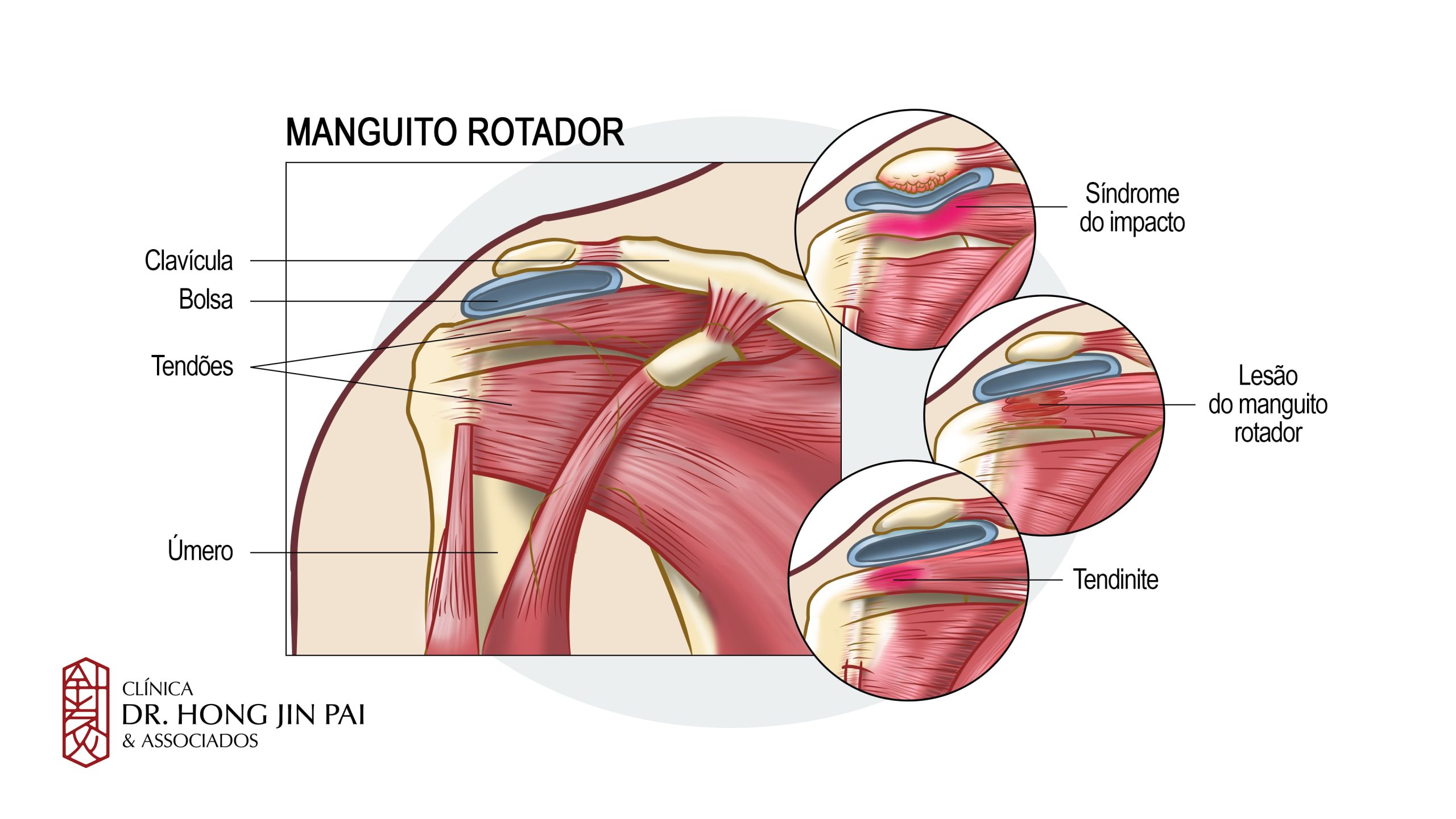 Ilustração anatômica do manguito rotador e do ombro